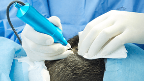 4.移植株の採取