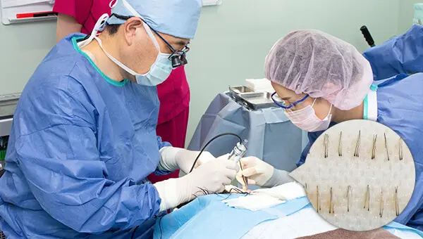 ①グラフト(毛髪の株)の採取