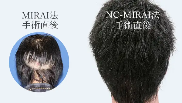 NC-MIRAI法