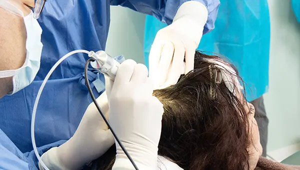 ②移植ホールの作成