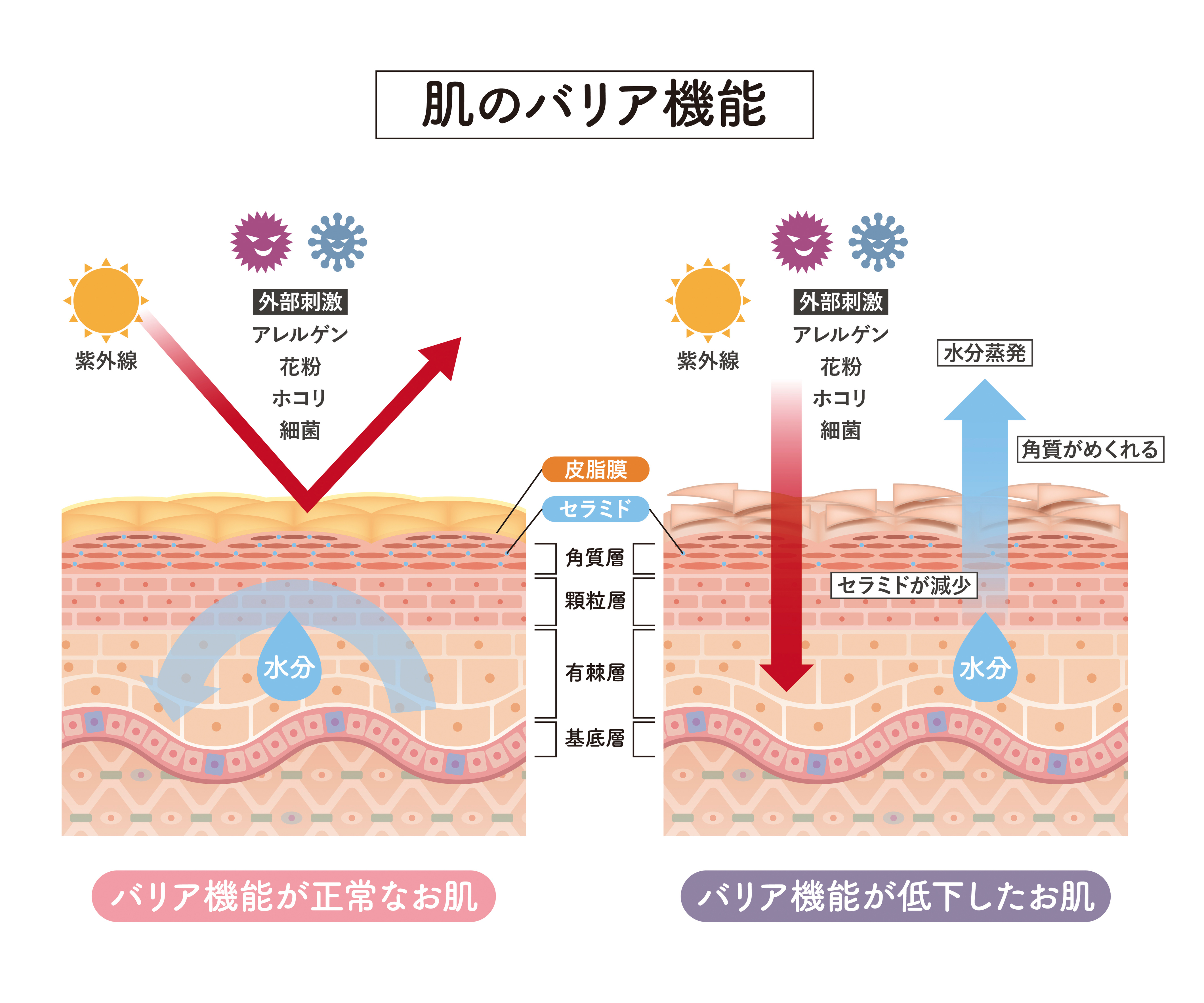 頭皮のバリア機能低下